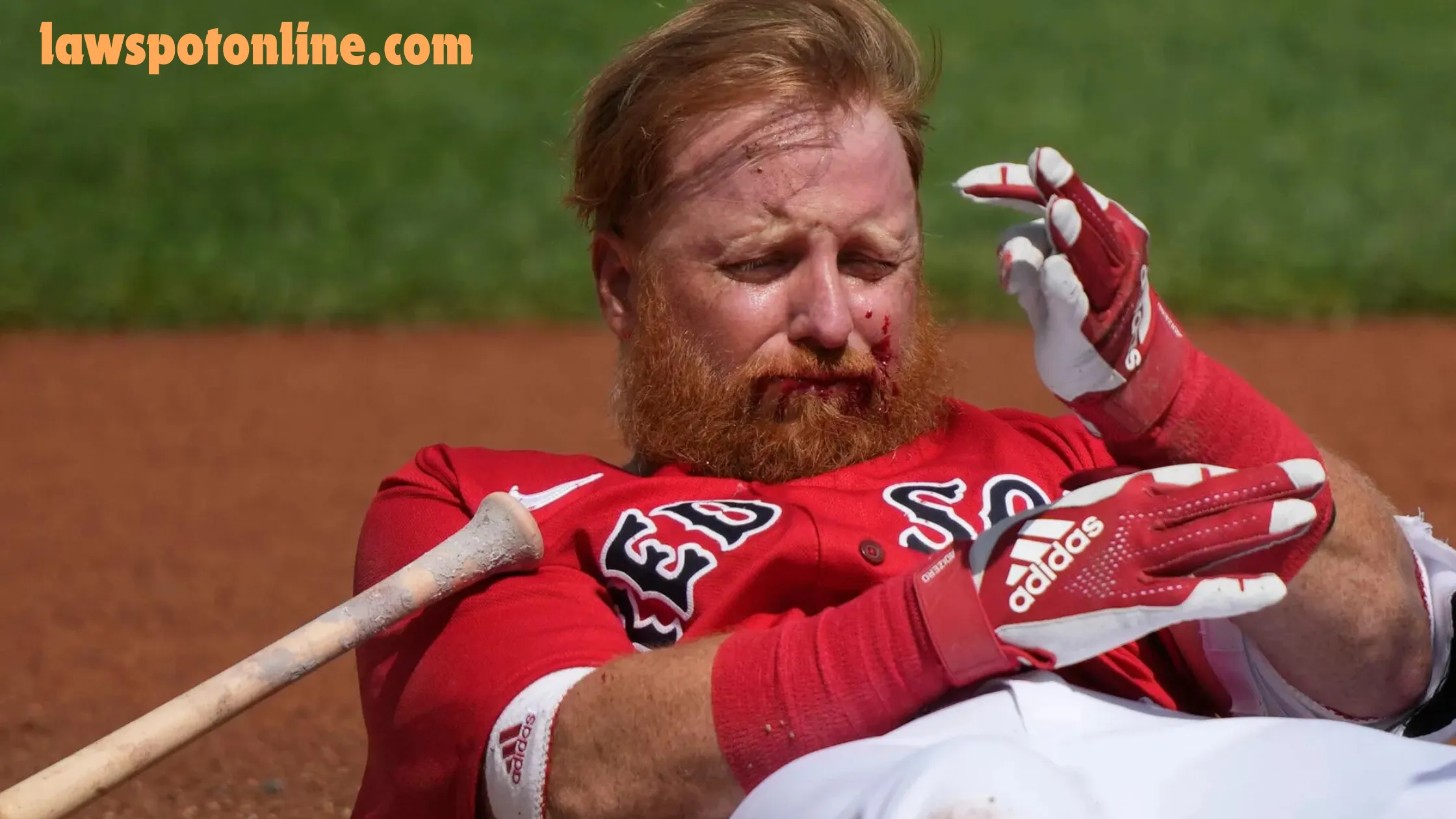 Justin Turner Texas Tech Accident